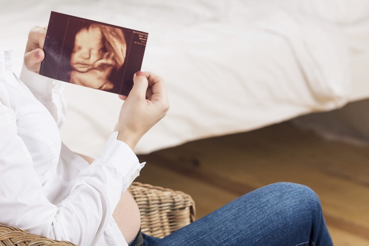 How can I prepare for my private pregnancy scan?