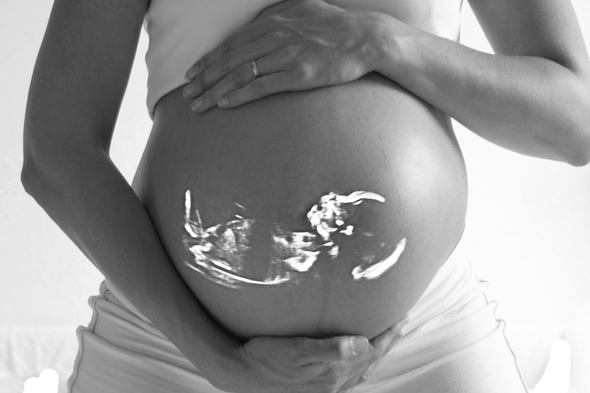 Safety of private Obstetrics Ultrasound